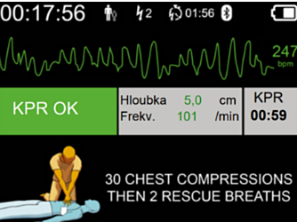 DefiSign Pocket Plus Opcja wyświetlacza EKG  - 11527
